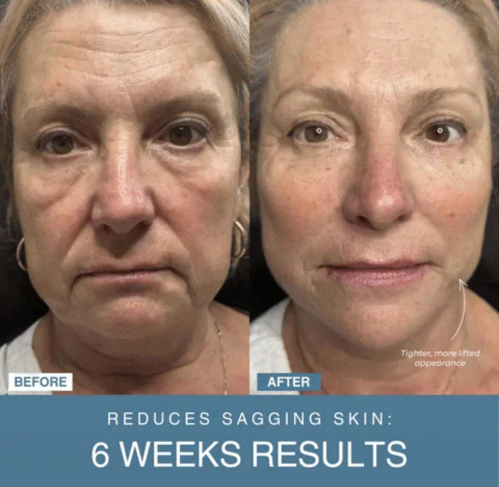 ᴀʟ ᴛᴀɪʙᴀ™ 7-in-1 LED Anti-Aging/Wrinkle Apparatus | جهاز مكافحة الشيخوخة وإزالة التجاعيد