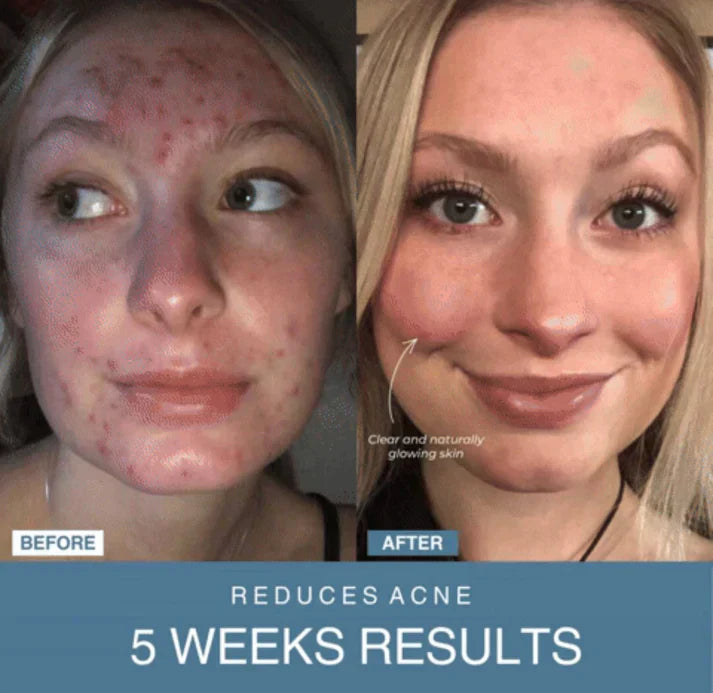 ᴀʟ ᴛᴀɪʙᴀ™ 7-in-1 LED Anti-Aging/Wrinkle Apparatus | جهاز مكافحة الشيخوخة وإزالة التجاعيد